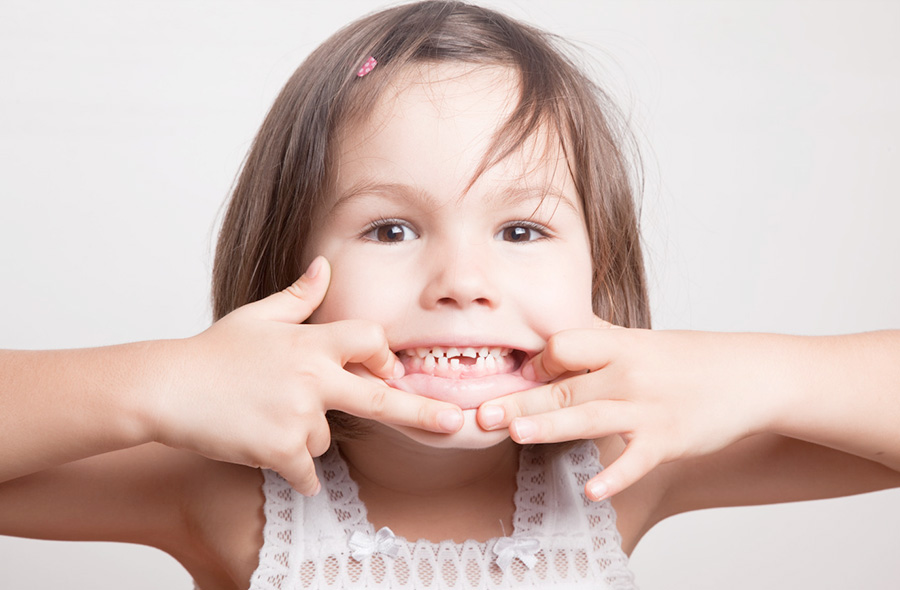 Dental Crowns Alpharetta, Johns Creek & Roswell Pediatric Dentist