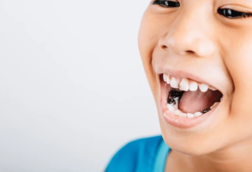 pediatric dentistry in alpharetta ga